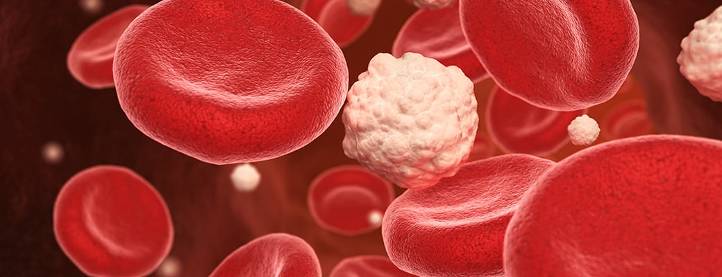Ratgeber Cholesterin Blutbild